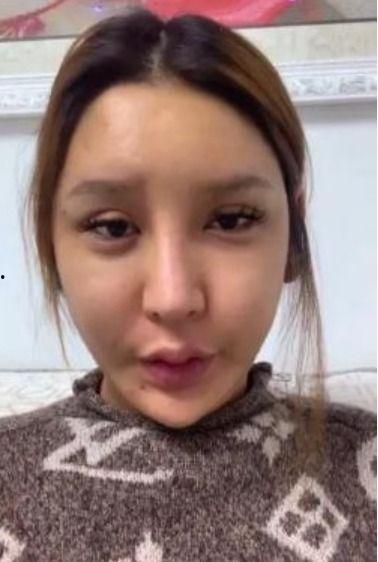 整容失败视频,整容失败视频揭示美丽背后的风险